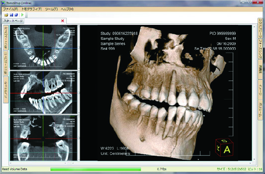 患者さんに優しい歯科診断へ（歯科用CT導入）