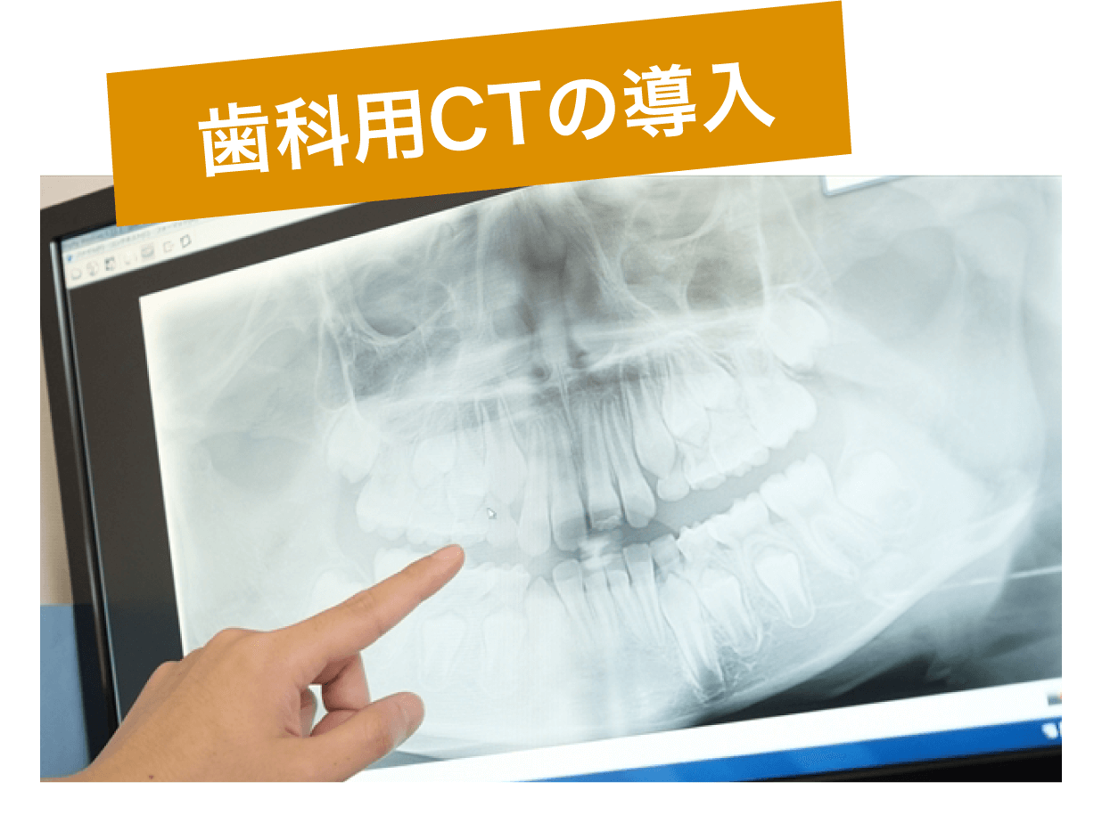 歯科用CTの導入